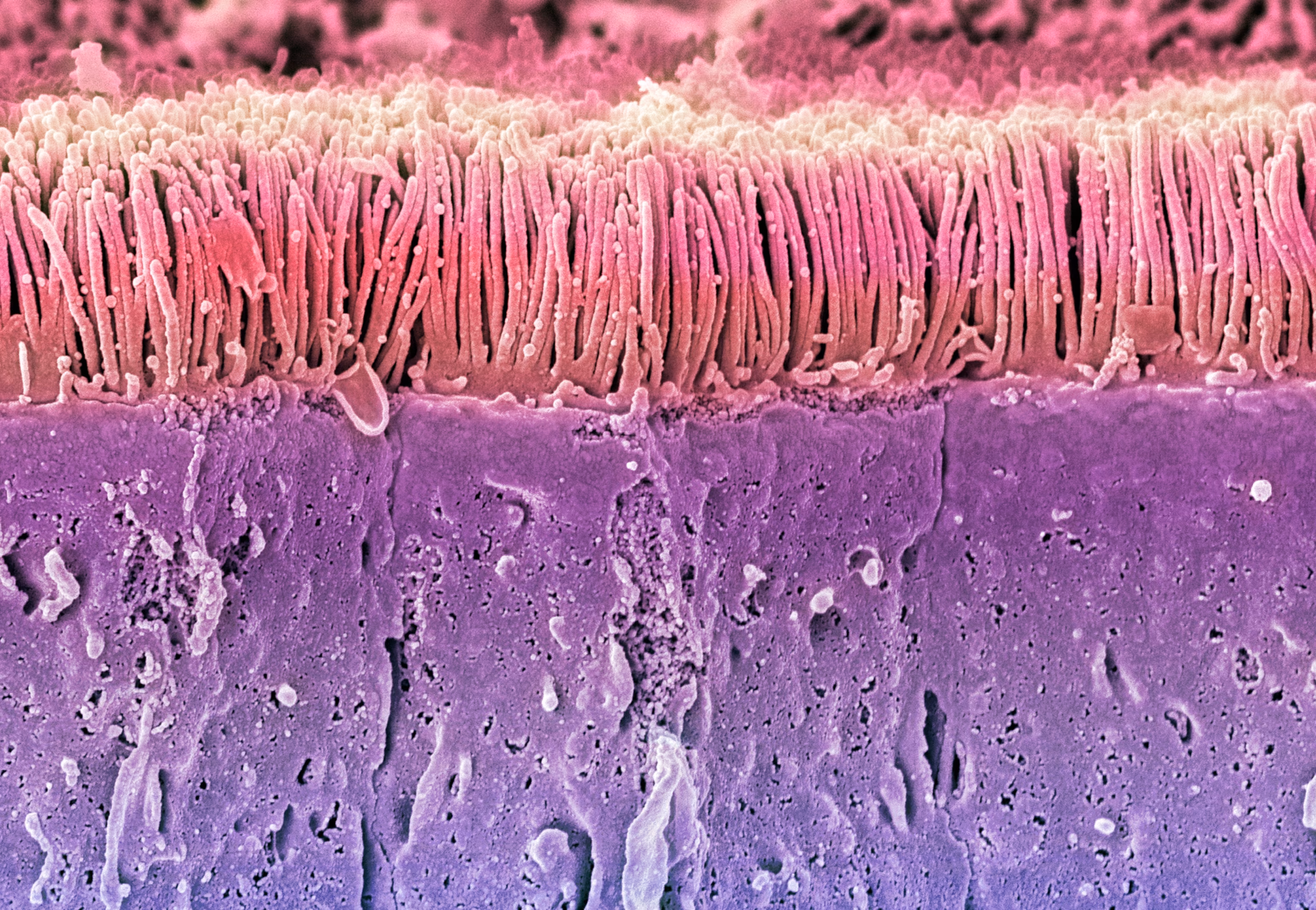 Scanning electron microscope image of intestinal microvilli showing gut health structures